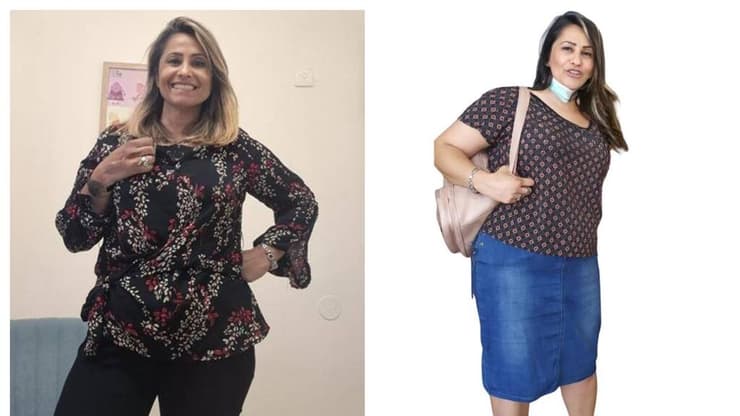 נועה ארזי לפני אחרי אברהמסון