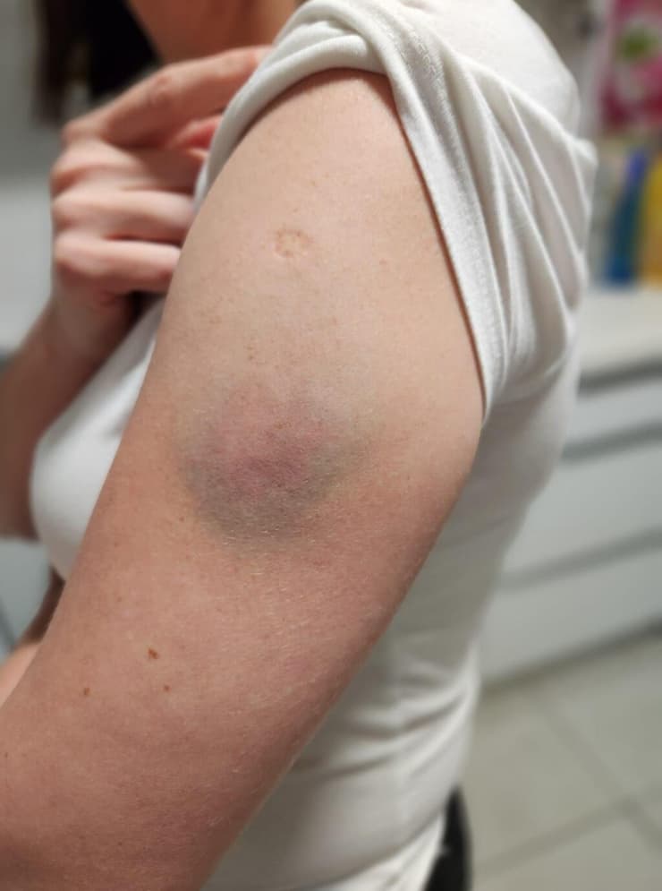 הפגיעה ביוליה חרתי באסותא