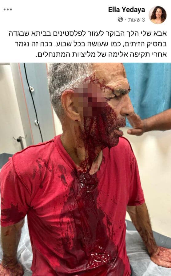 נפצע בתקיפה על ידי מתנחלים