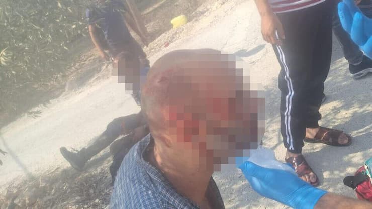 הפלסטינים שהותקפו בכפר בורין