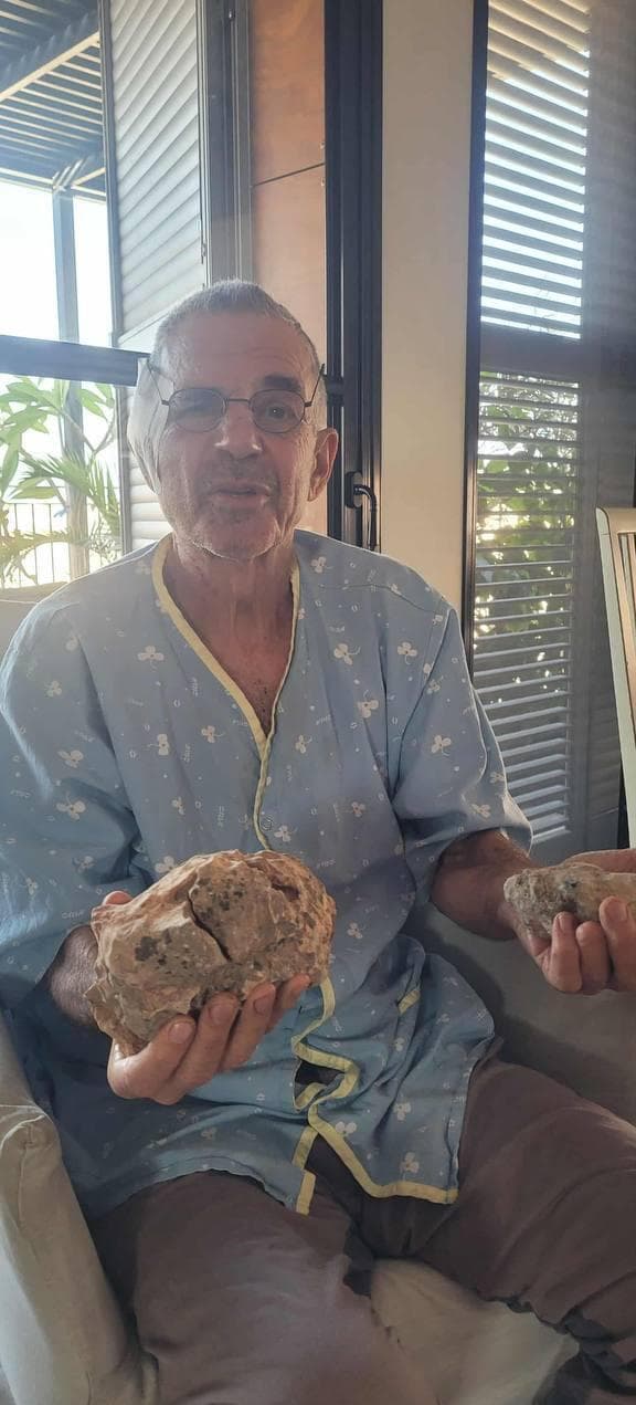 עודד ידעיה מחזיק את האבנים שנזרקו עליו