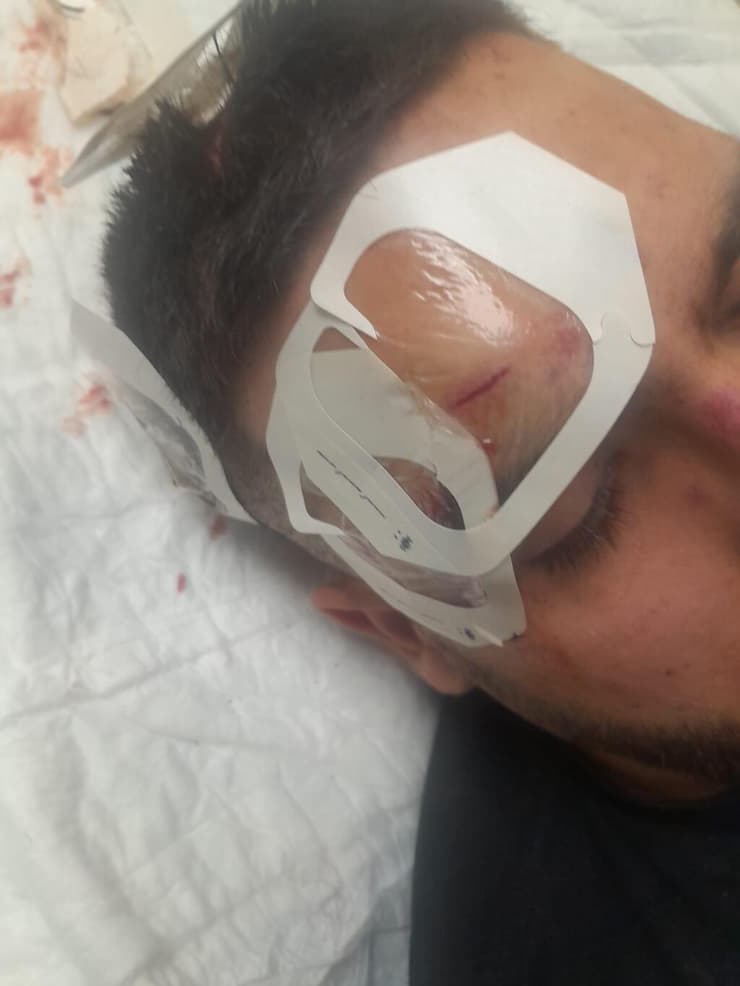 "אני עדיין בהלם" (צילום: דוברות בני סכנין) מוחמד אבו ריא