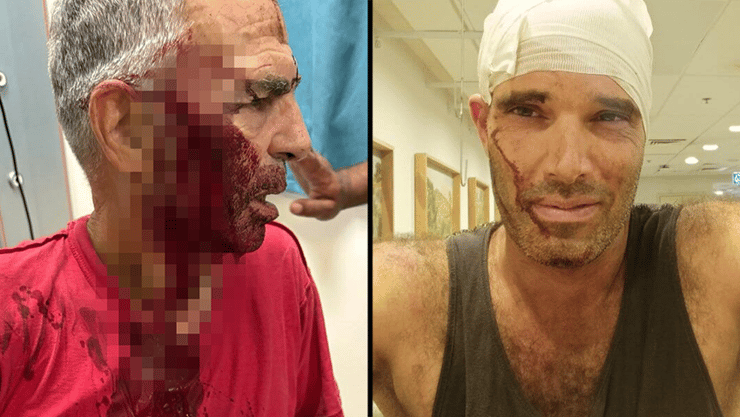 עודד ידעיה מחזיק את האבנים שנזרקו עליו, יובל בן ארי