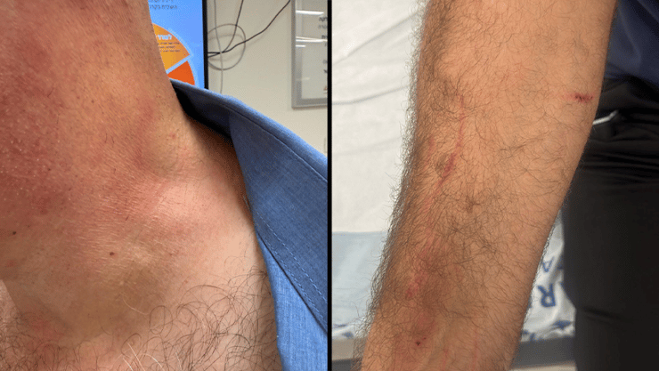 הנהגים שהותקפו במודיעין עילית ובשדרות (צילום: כוח לעובדים, ארגון נהגי האוטובוסים מבית ההסתדרות הלאומית) נהג אוטובוס שהותקף בשדרות ומודיעין עילית