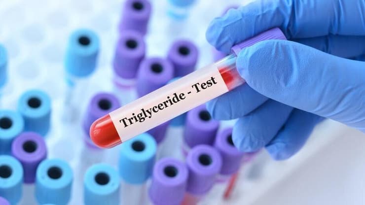 רמות הטריגליצרידים בדם משמשות מדד חשוב לבריאות המטבולית (צילום: Shutterstock) טריגליצרידים, שומנים בדם