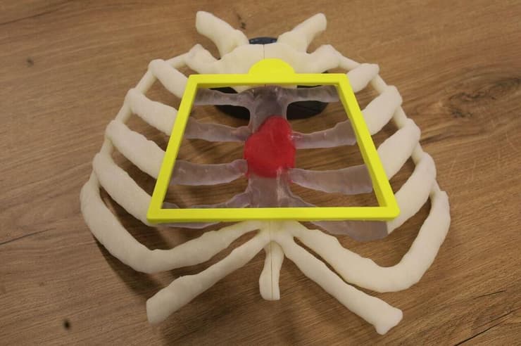 מודל כלוב הצלעות שהופק בתלת-ממד