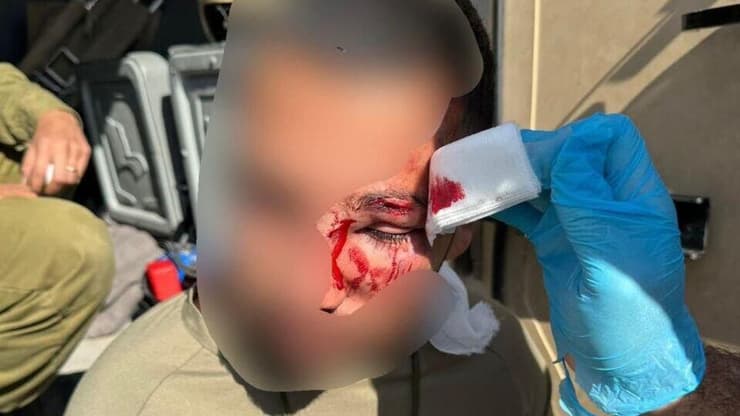 אחד מהלוחמים שנפצעו (צילום: דוברות המשטרה) פצועים בפינוי התנחלות מאחז לא חוקי צור משגבי