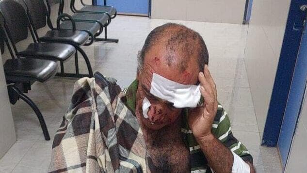 הותקפו על ידי מתנחלים במסאפר יטא