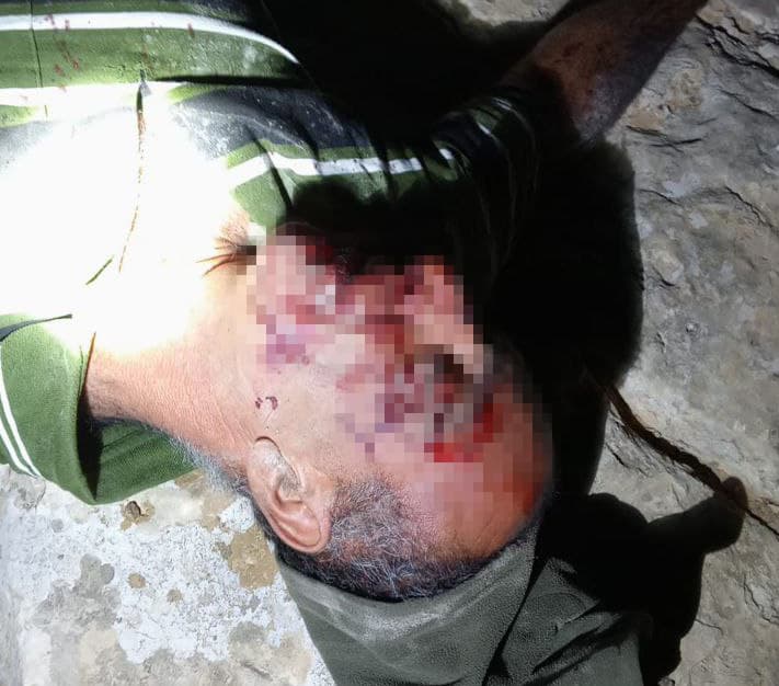 הותקפו על ידי מתנחלים במסאפר יטא