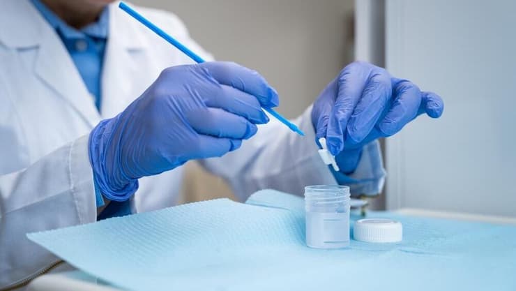 בדיקה לגילוי נגיף הפפילומה