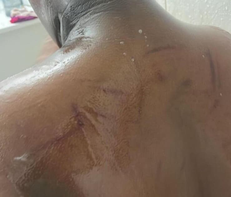 ילד בן 11 על הרצף האוטיסטי שעובר התעללות בבית הספר