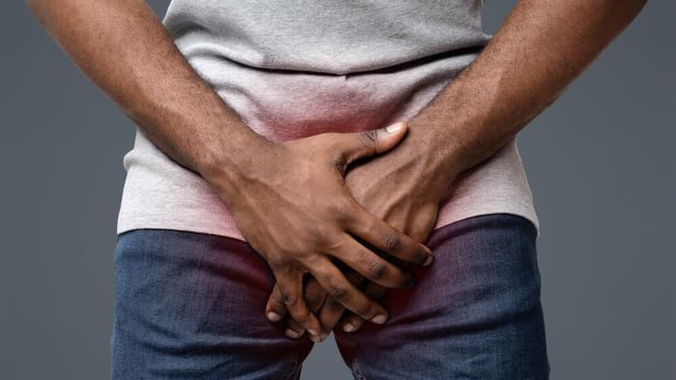 אין אונות אימפוטנציה הפרעות זקפה הפרעה בתפקוד המיני גברים