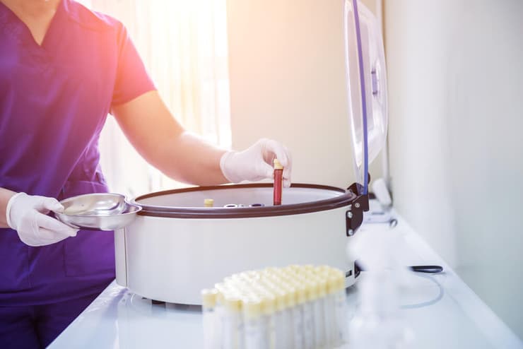 פלזמה טיפול PRP בדיקת דם צנטריפוגה