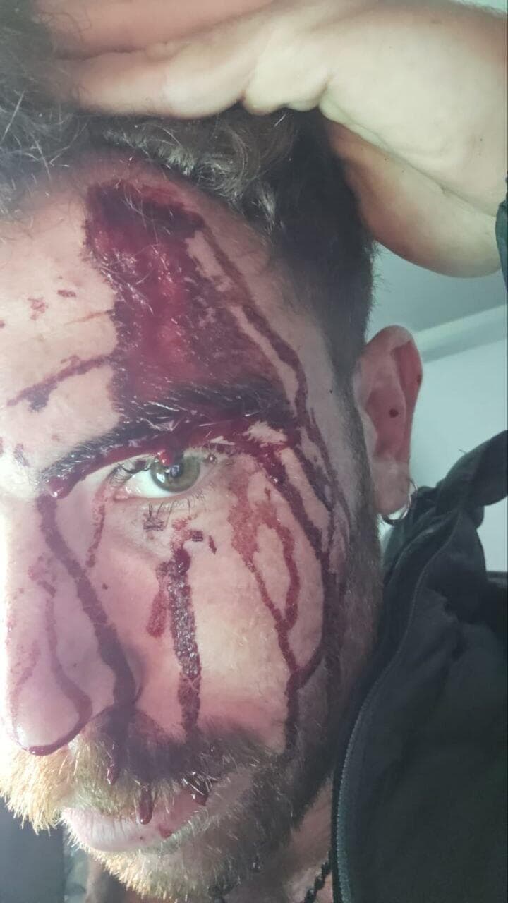 ישראלי הותקף באכזריות על ידי חבורת נפאלים בקטמנדו