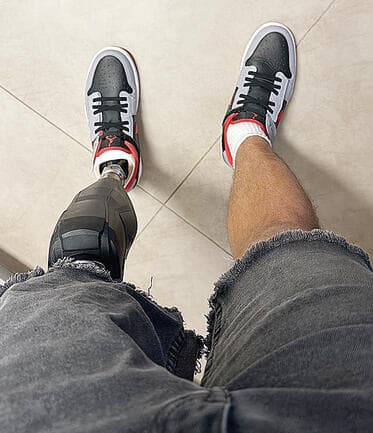 "הבעיה הכי משמעותית היא הצורה של הנעל". נעליים מיוחדות שמתאימות לפרוטזות וסדים עליים מיוחדות שמתאימות לפרוטזות וסדים