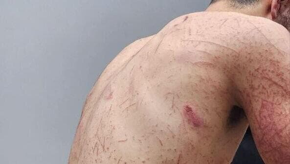 אוויס הומאם דיב, הצעיר הפלסטיני שהותקף בידי מתנחלים