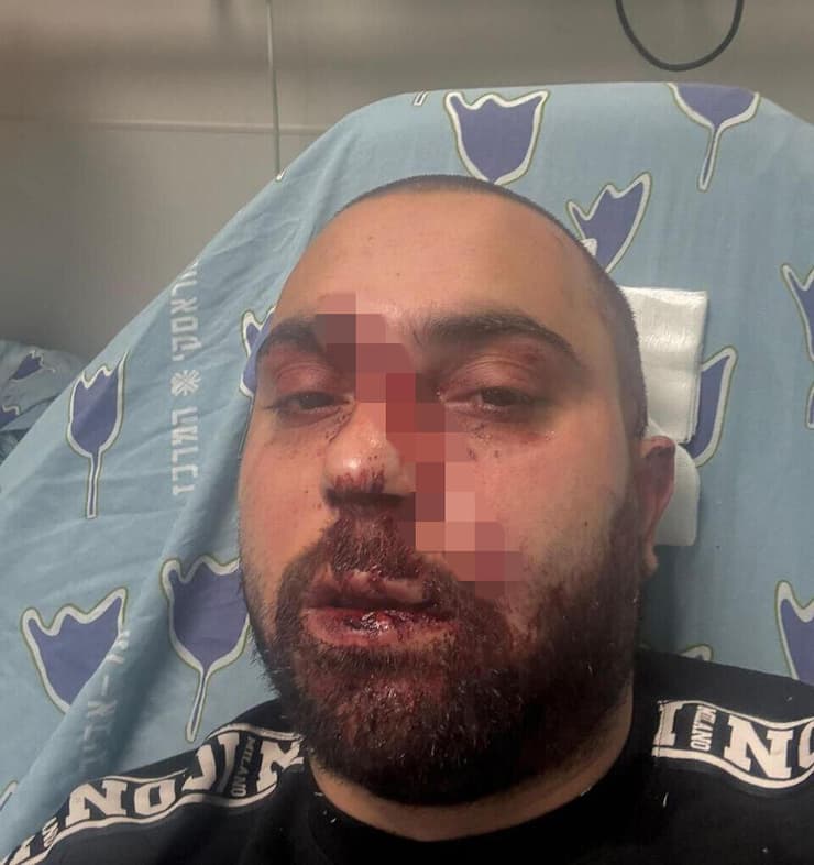 אגבאריה, שהותקף בתל אביב. "אי אפשר לשתוק על זה" מחמוד אגבאריה שהותקף בתל אביב