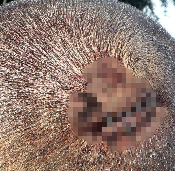 מחמוד אגבאריה שהותקף בתל אביב