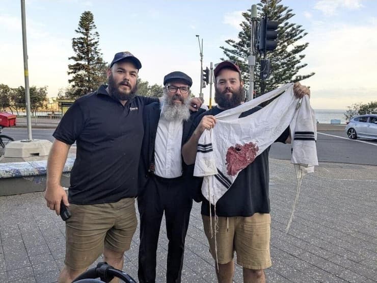 טלית מוכתמת בדם, הבוקר ליד זירת האירוע בסידני (צילום: לפי סעיף 27א' לזכויות יוצרים ) תיעוד: ירי המוני במסיבת חנוכה בסידני שבאוסטרליה