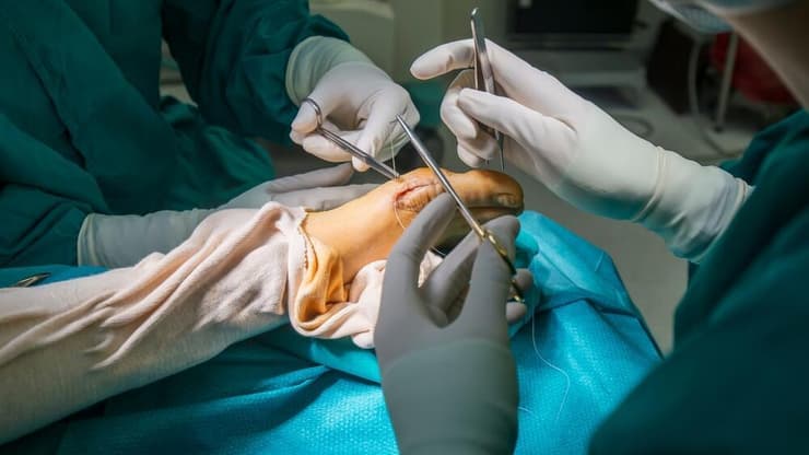 הלוקס ולגוס