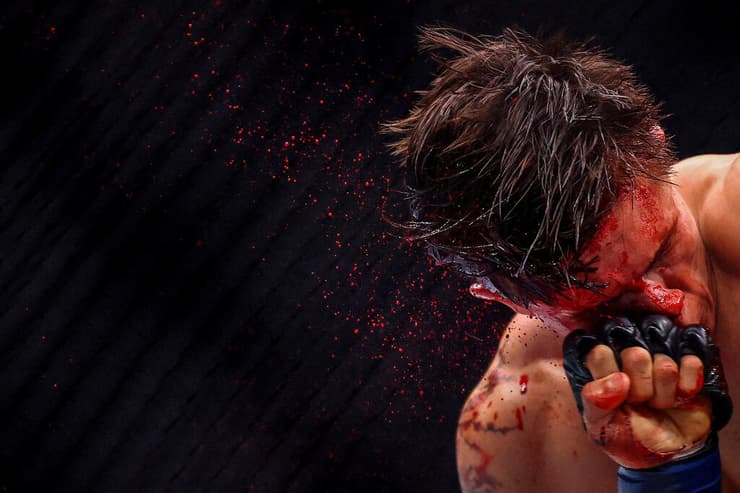 על הפנים. לונ'ר קוואנה חוטף בקרב UFC (צילום: Reuters/Andrew Boyers) על הפנים: קרב אמנות לחימה משולב בין לונ'ר קוואנה ופליפה דוס סנטוס