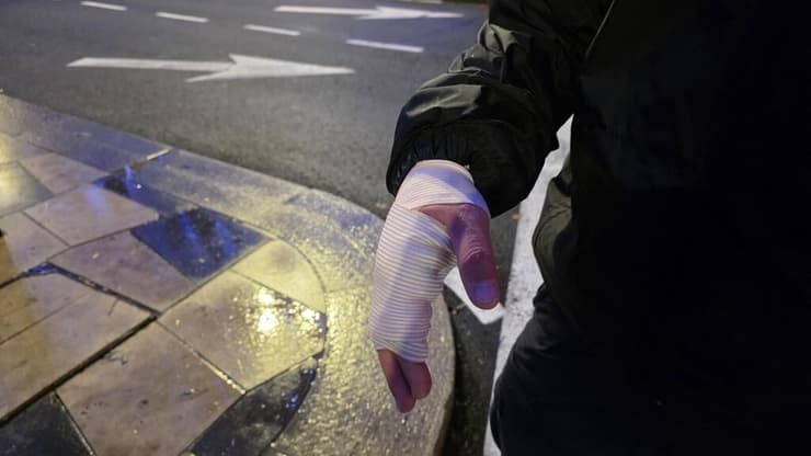 שוטר נפצע במהלך פיזור הפגנה בכניסה לירושלים עם ציון חמש שנים למותו של אהוביה סנדק