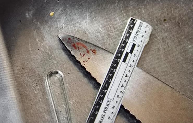 תושבת ירושלים תקפה את בן זוגה