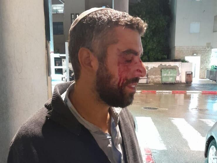 הרב אביטן, לאחר התקיפה הרב לאחר התקיפה