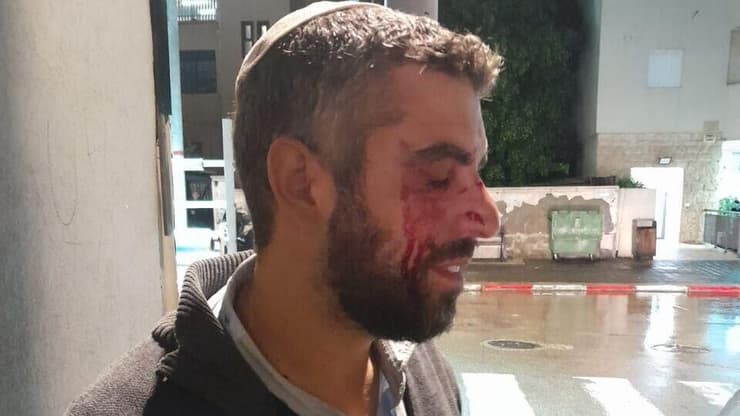 הרב לאחר התקיפה