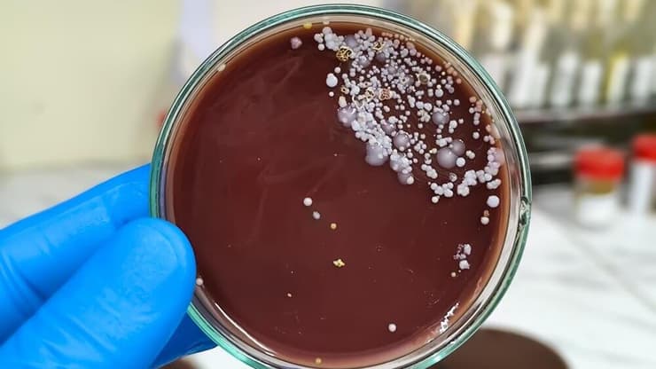 קנדידה אוריס (Candida auris)