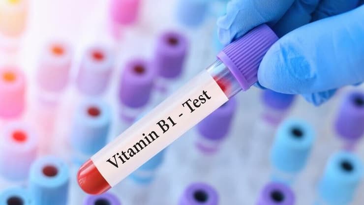 החוקרים משיבא ממליצים: מעקב אחר רמות ויטמין B1 למטופלים בתרופות ממשפחת GLP-1 (צילום: Shutterstock) ויטמין B1
