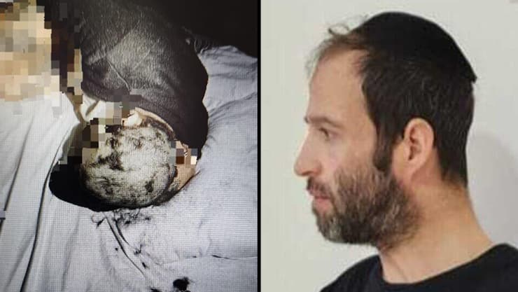 אברהם פרלמוטר, ואחת מקורבנותיו מגולחת ראש (צילום: מתוך הרשתות החברתיות לפי סעיף 27 א') אברהם פרלמוטר