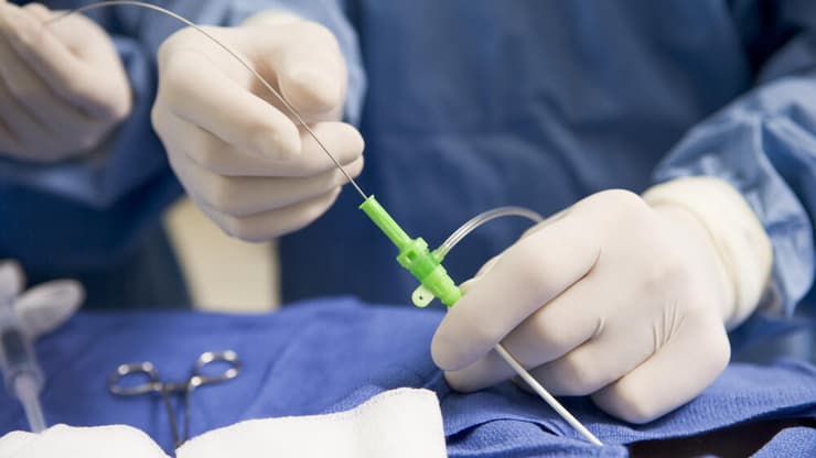 "מהלך חד-צדדי, שבוצע ללא דיאלוג מקצועי מסודר" (צילום: shutterstock) צנתור בבית חולים