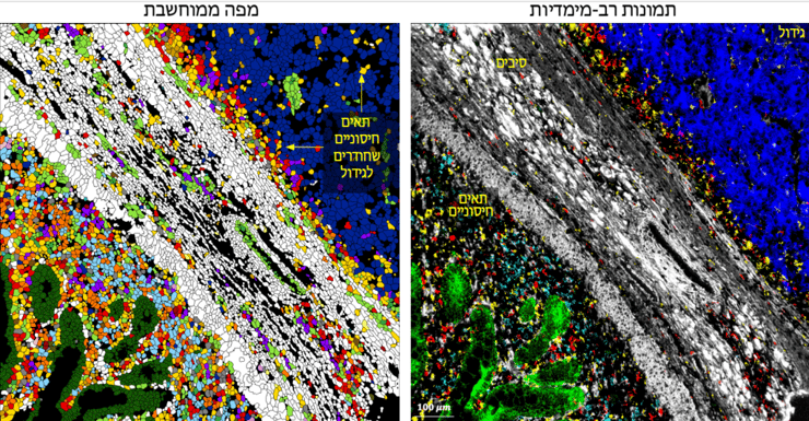תמונה של סרטן עור מסוג מלנומה. ימין: כל צבע מראה חלבון שונה ברקמה. שמאל: מפה ממוחשבת של התמונה הימנית. תאים חיסוניים מסוגים שונים (אדום וצהוב) מתקשרים עם תאי הגידול (כחול). הניסוי הובל בידי סמיחה מתוולי