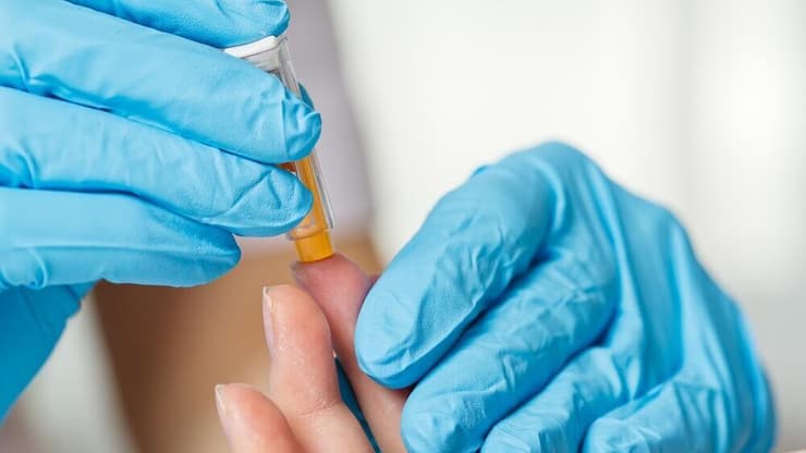 בדיקת דם, דקירה