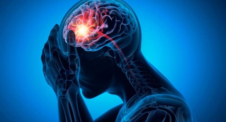 "הרופאים היו עושים CT ו-MRI - ולא מצליחים להדגים מהיכן הנוזל דולף" (הדמיה: shutterstock) לחץ פנים גולגלתי