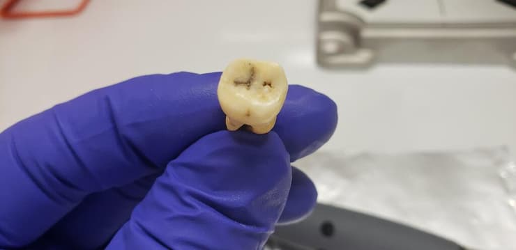 שן שהתגלתה באתר הארכאולוגי בג'רש