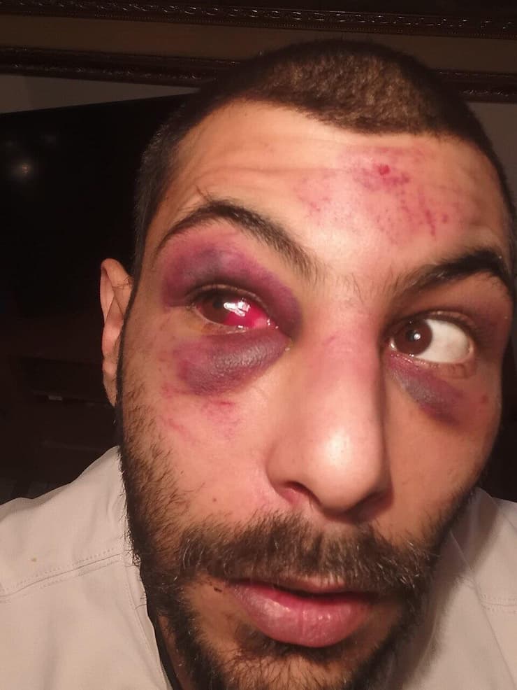 מעצר אלים של תושב טייבה