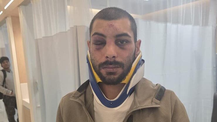 מעצר אלים של תושב טייבה