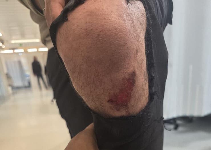 מעצר אלים של תושב טייבה