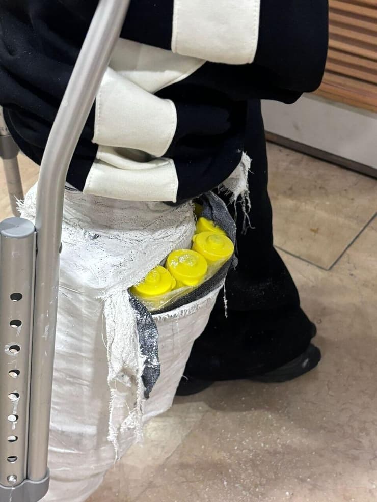 הגבס והאבוקות