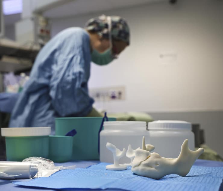 משתל העצם שהוכן בבנק הרקמות 