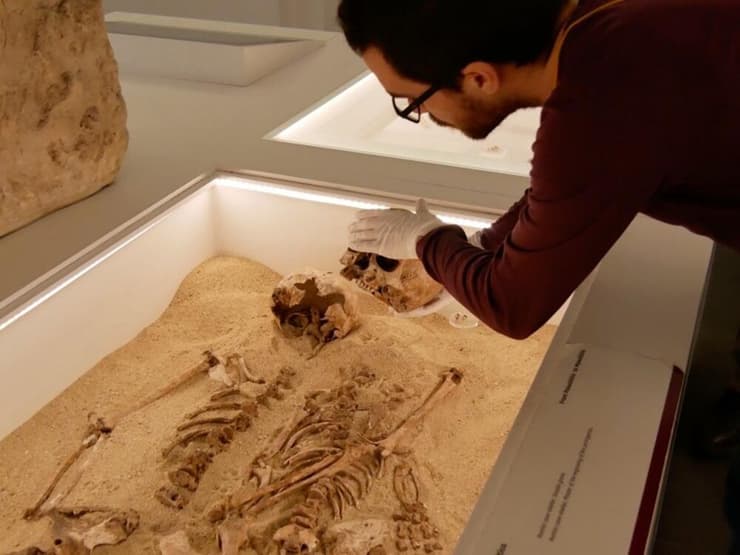 איסוף דגימות מהשלד של הנערה "רומיטו 2" שסבלה מגמדות (צילום: Adrian Daly) איסוף דגימות מהשלד של הנערה "רומיטו 2" שסבלה מגמדות