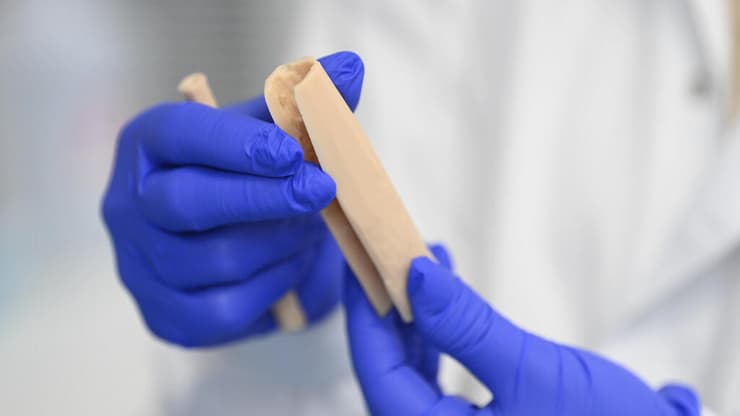 בנק הרקמות, שיבא