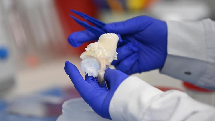 בנק הרקמות, שיבא