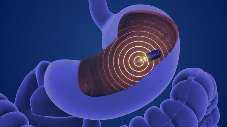 הקפסולה החכמה: משדרת מהקיבה ומאשרת שהתרופה נלקחה. אילוסטרציה (צילום: Shutterstock) קפסולה, קיבה