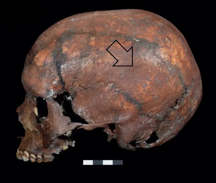 גולגולת הנער, עם הסימן שרמז על תקיפת דוב (צילום: מתוך כתב העת Journal of Anthropological Sciences) גולגולת הנער, עם הסימן שרמז על תקיפת דוב