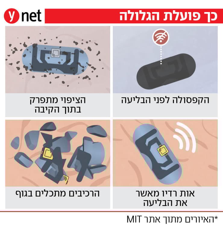 גלולה MIT גלולה MIT