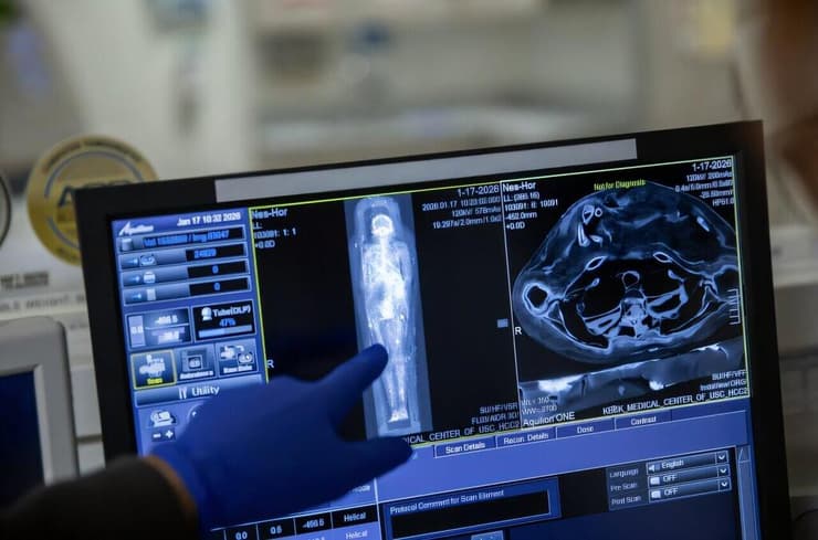 ניתוח סריקת ה-CT שבוצעה למומיה של כוהן הדת המצרי נס-חור