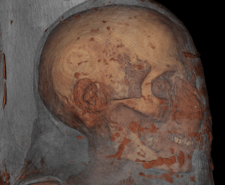 סריקת הגולגולת של כוהן הדת המצרי נס-חור